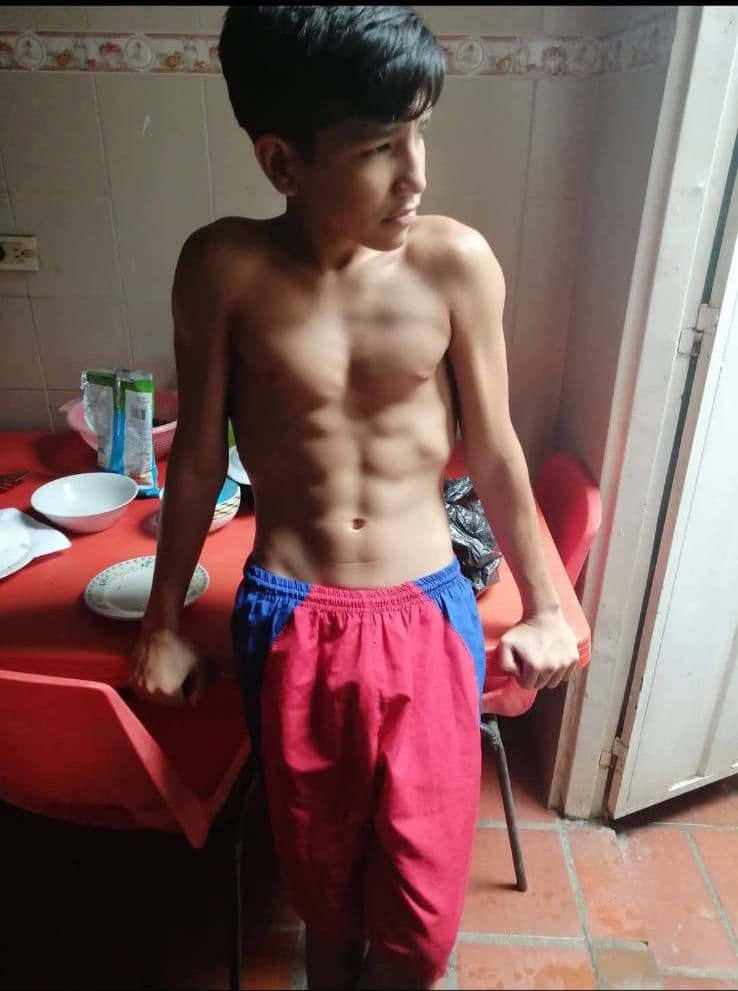 Testimonio Jhoan Antes